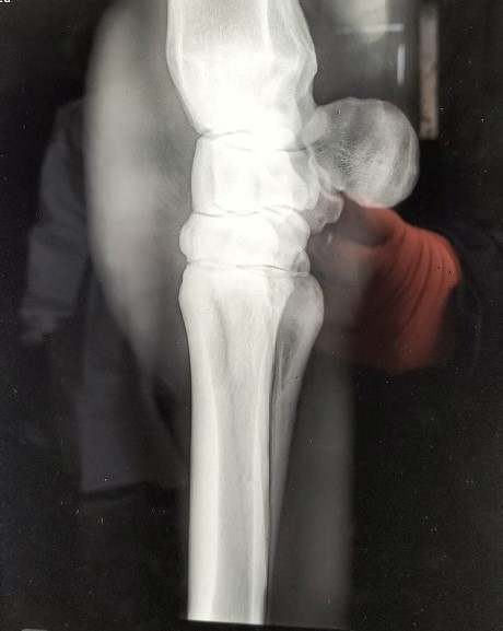 Abbey Xray 1